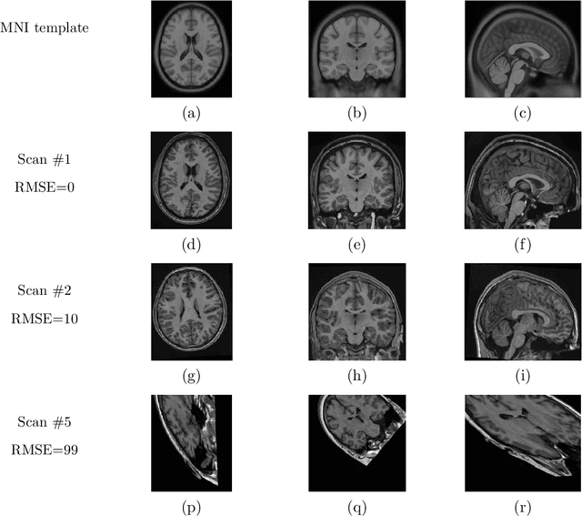 Figure 4 for RegQCNET: Deep Quality Control for Image-to-template Brain MRI Registration