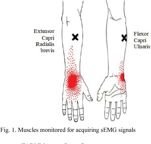 Figure 1 for Dual Stage Classification of Hand Gestures using Surface Electromyogram