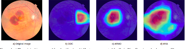 Figure 4 for Multi-Label Retinal Disease Classification using Transformers