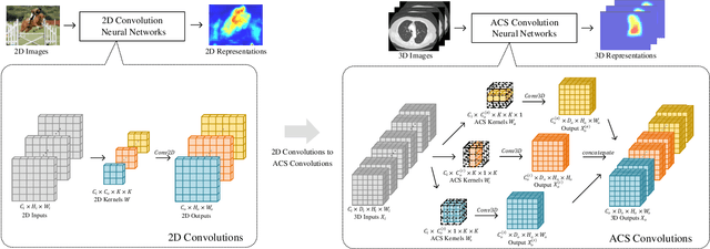 Figure 3 for Reinventing 2D Convolutions for 3D Medical Images