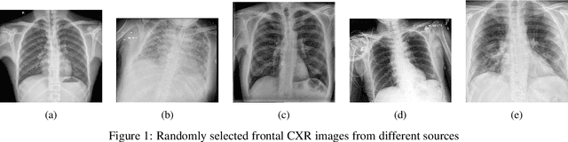 Figure 1 for COVID-CXNet: Detecting COVID-19 in Frontal Chest X-ray Images using Deep Learning