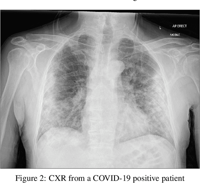 Figure 2 for COVID-CXNet: Detecting COVID-19 in Frontal Chest X-ray Images using Deep Learning