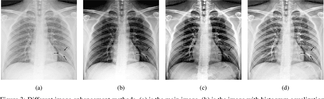 Figure 3 for COVID-CXNet: Detecting COVID-19 in Frontal Chest X-ray Images using Deep Learning