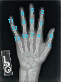 Figure 2 for A Deep Framework for Bone Age Assessment based on Finger Joint Localization