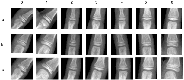 Figure 3 for A Deep Framework for Bone Age Assessment based on Finger Joint Localization