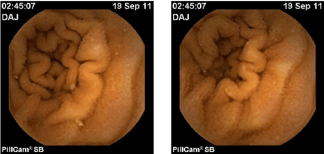 Figure 1 for An Elastic Image Registration Approach for Wireless Capsule Endoscope Localization