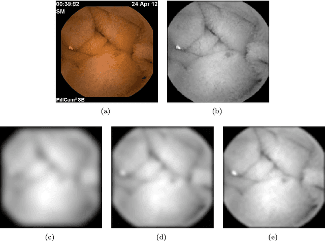 Figure 3 for An Elastic Image Registration Approach for Wireless Capsule Endoscope Localization