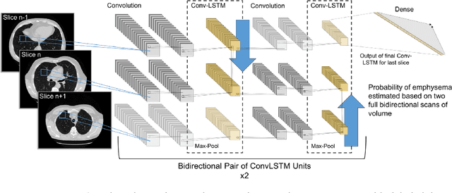 Figure 1 for Disease Detection in Weakly Annotated Volumetric Medical Images using a Convolutional LSTM Network