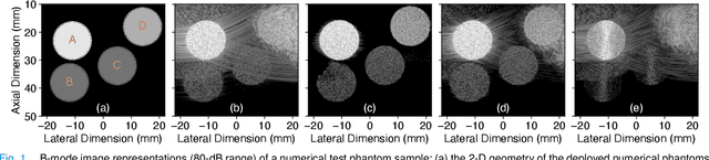 Figure 1 for CNN-Based Ultrasound Image Reconstruction for Ultrafast Displacement Tracking