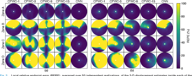 Figure 2 for CNN-Based Ultrasound Image Reconstruction for Ultrafast Displacement Tracking