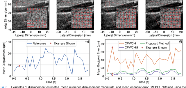 Figure 3 for CNN-Based Ultrasound Image Reconstruction for Ultrafast Displacement Tracking