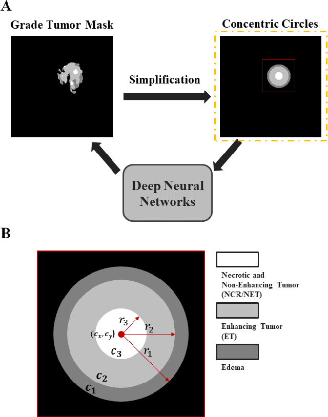 Figure 3 for Synthesis of Brain Tumor MR Images for Learning Data Augmentation