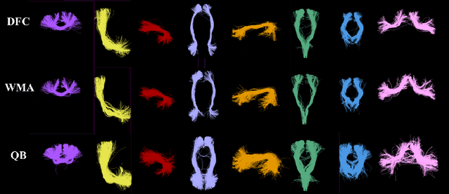 Figure 3 for Deep Fiber Clustering: Anatomically Informed Unsupervised Deep Learning for Fast and Effective White Matter Parcellation