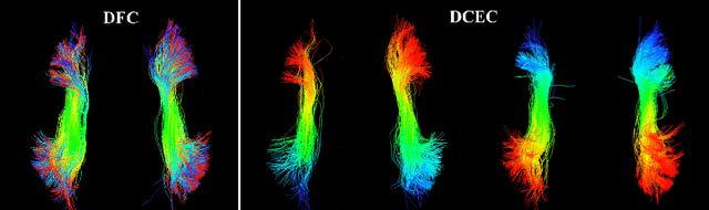 Figure 4 for Deep Fiber Clustering: Anatomically Informed Unsupervised Deep Learning for Fast and Effective White Matter Parcellation