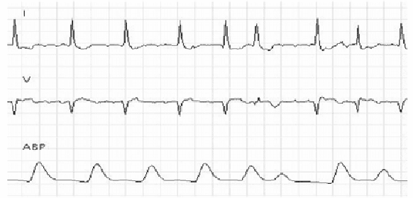 Figure 1 for Learning rules from multisource data for cardiac monitoring