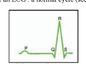 Figure 3 for Learning rules from multisource data for cardiac monitoring