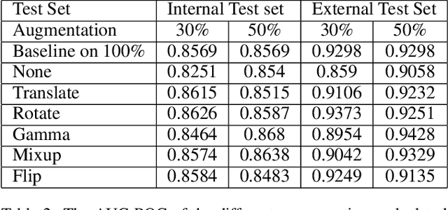 Figure 4 for Reducing Labelled Data Requirement for Pneumonia Segmentation using Image Augmentations