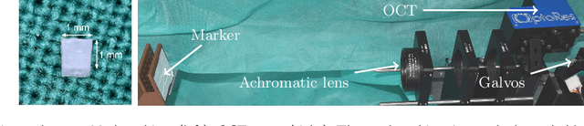 Figure 3 for 4D Spatio-Temporal Convolutional Networks for Object Position Estimation in OCT Volumes