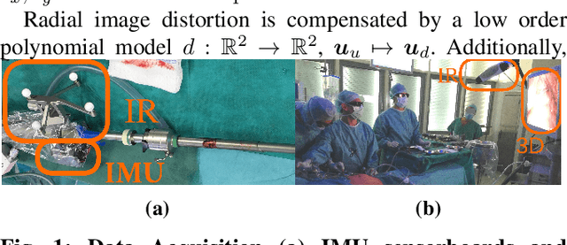 Figure 1 for Constrained Visual-Inertial Localization With Application And Benchmark in Laparoscopic Surgery