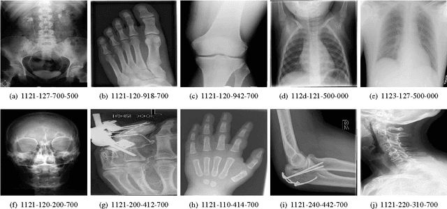 Figure 4 for Medical Image Classification via SVM using LBP Features from Saliency-Based Folded Data