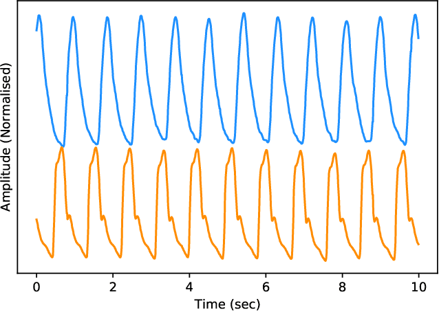 Figure 3 for Estimation of Continuous Blood Pressure from PPG via a Federated Learning Approach