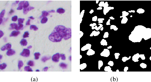 Figure 1 for CAggNet: Crossing Aggregation Network for Medical Image Segmentation