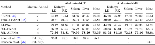 Figure 4 for Self-Supervision with Superpixels: Training Few-shot Medical Image Segmentation without Annotation