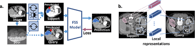 Figure 1 for Self-Supervision with Superpixels: Training Few-shot Medical Image Segmentation without Annotation