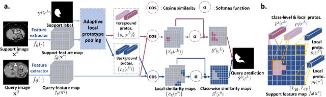 Figure 3 for Self-Supervision with Superpixels: Training Few-shot Medical Image Segmentation without Annotation