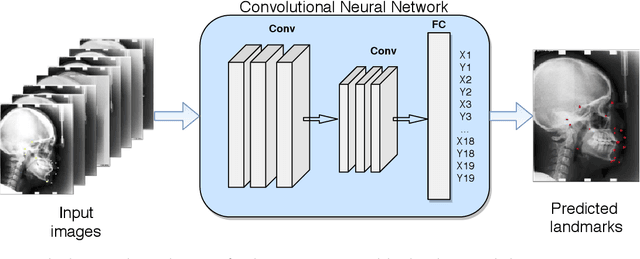 Figure 1 for Convolutional Neural Networks in Orthodontics: a review