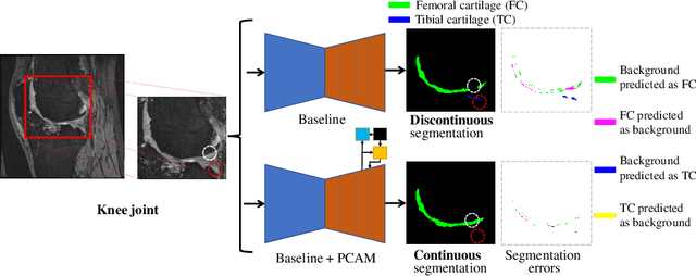 Figure 1 for Position-prior Clustering-based Self-attention Module for Knee Cartilage Segmentation