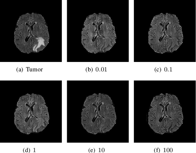 Figure 4 for An Adversarial Learning Approach to Medical Image Synthesis for Lesion Removal