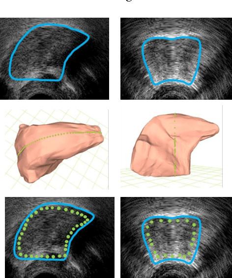 Figure 2 for Development of a 3D tongue motion visualization platform based on ultrasound image sequences
