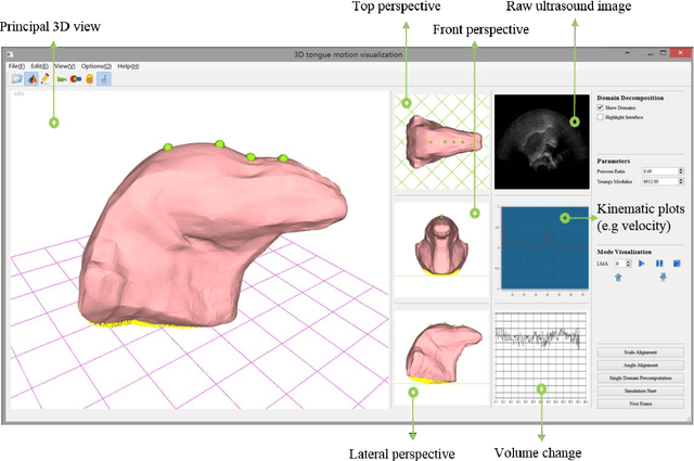 Figure 3 for Development of a 3D tongue motion visualization platform based on ultrasound image sequences