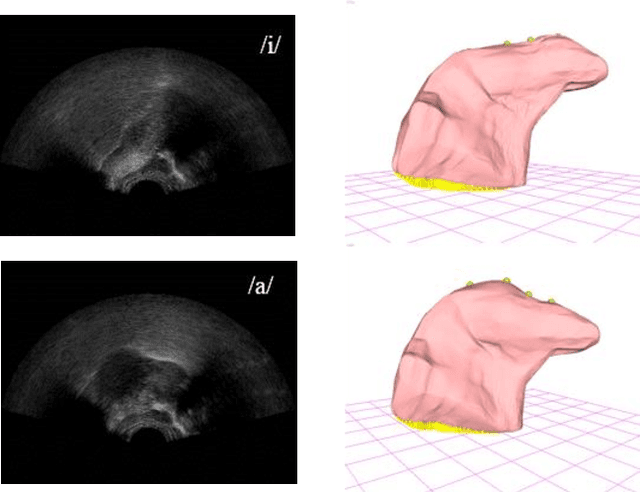 Figure 4 for Development of a 3D tongue motion visualization platform based on ultrasound image sequences