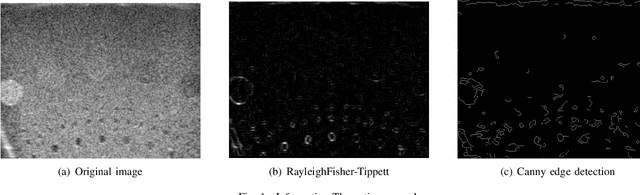 Figure 1 for Feature matching in Ultrasound images