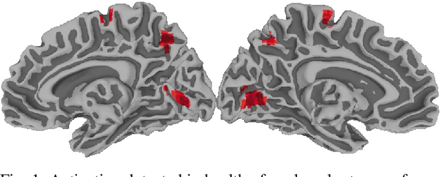 Figure 1 for A Practical Model-based Segmentation Approach for Accurate Activation Detection in Single-Subject functional Magnetic Resonance Imaging Studies
