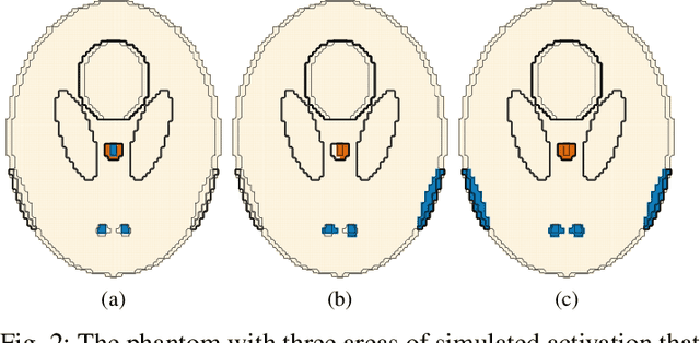 Figure 2 for A Practical Model-based Segmentation Approach for Accurate Activation Detection in Single-Subject functional Magnetic Resonance Imaging Studies