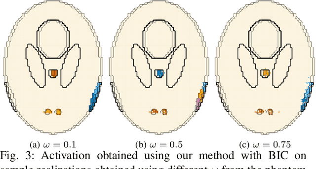 Figure 3 for A Practical Model-based Segmentation Approach for Accurate Activation Detection in Single-Subject functional Magnetic Resonance Imaging Studies