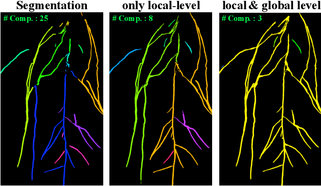 Figure 3 for Blind Inpainting of Large-scale Masks of Thin Structures with Adversarial and Reinforcement Learning