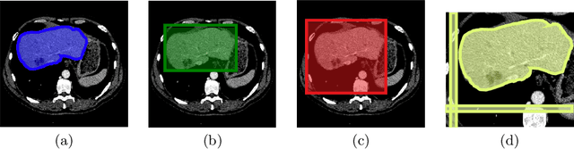 Figure 1 for Medical image segmentation with imperfect 3D bounding boxes