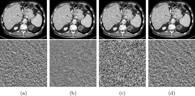 Figure 3 for Self-Supervised Learning based CT Denoising using Pseudo-CT Image Pairs