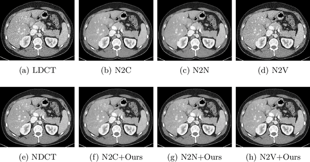 Figure 4 for Self-Supervised Learning based CT Denoising using Pseudo-CT Image Pairs