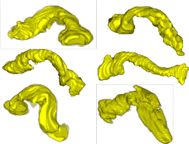 Figure 1 for A Bottom-up Approach for Pancreas Segmentation using Cascaded Superpixels and (Deep) Image Patch Labeling