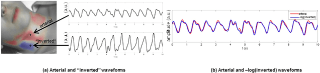 Figure 3 for Non-contact hemodynamic imaging reveals the jugular venous pulse waveform