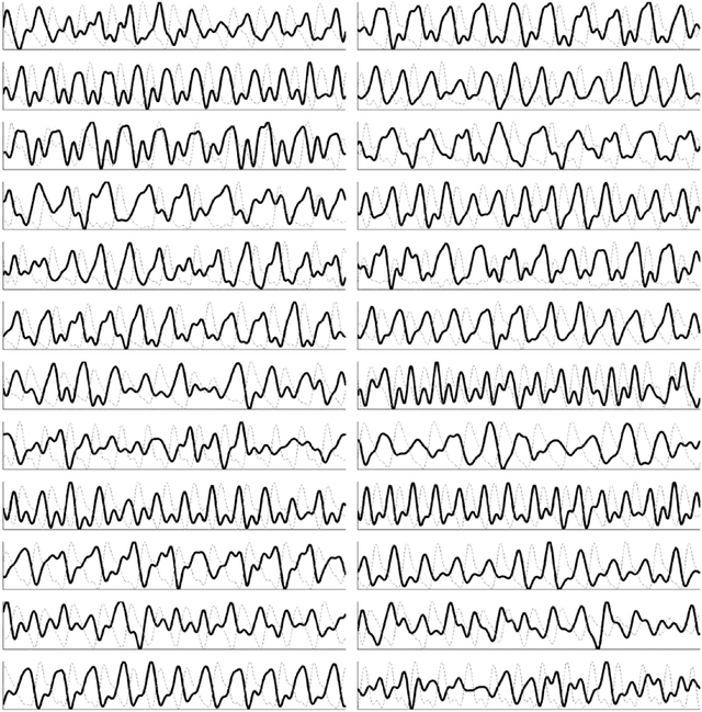 Figure 4 for Non-contact hemodynamic imaging reveals the jugular venous pulse waveform