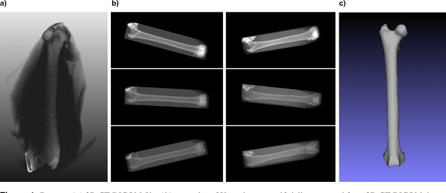 Figure 1 for Estimating and abstracting the 3D structure of bones using neural networks on X-ray (2D) images