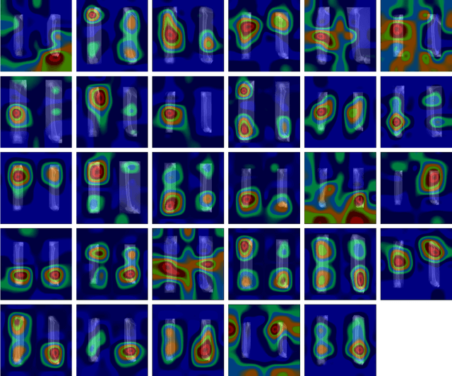 Figure 3 for Estimating and abstracting the 3D structure of bones using neural networks on X-ray (2D) images