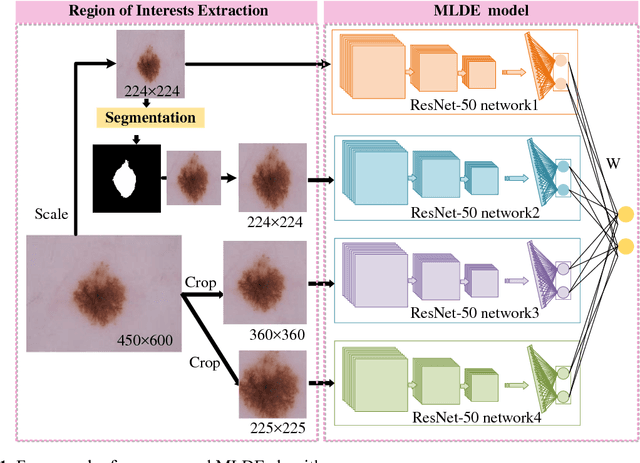 Figure 1 for A Multi-Level Deep Ensemble Model for Skin Lesion Classification in Dermoscopy Images