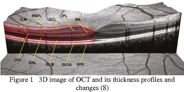 Figure 1 for Accurate automatic segmentation of retina layers with emphasis on first layer